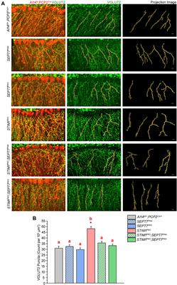 Deficits Associated With Loss of STIM1 in Purkinje Neurons Including Motor Coordination Can Be Rescued by Loss of Septin 7